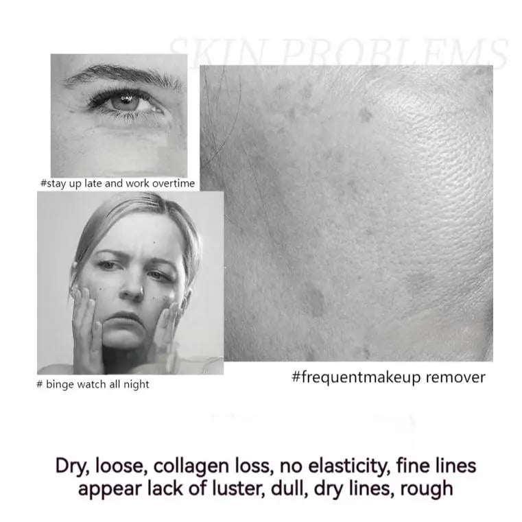 💥🔥 2025 NEW Polypeptide firming full face cream